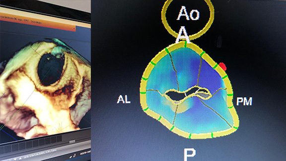 medico cardiologo